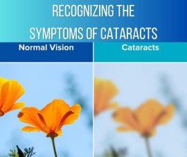 Recognizing the Symptoms of Cataracts